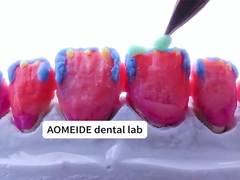 Güç Doğal Estetik Katı Zirkonya Tacı Tek veya Çoklu Dişler için Mükemmel