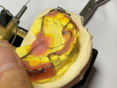 Özel yapılmış iyi tutma ve ayarlanabilir özelliklere sahip ortodontik cihaz