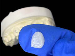 IPS e.max A1 tonunda kesici için kaplamalar Kusursuz Gülümsemeler için Doğal Estetik