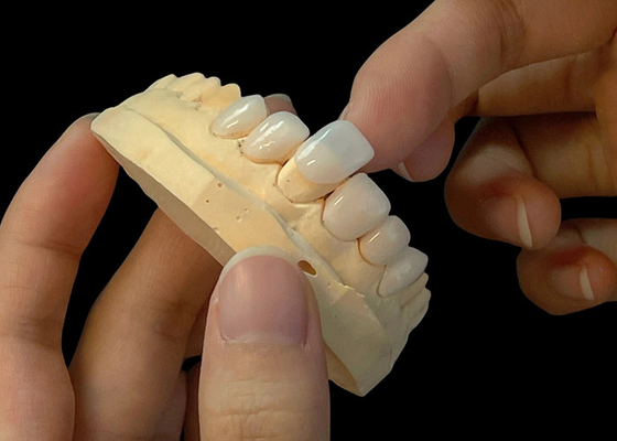 satın al Porselen Gölgesi Ultra İnce EMAX Finerleri Estetik Restorasyonlar İçin leke Direnci online manufacture