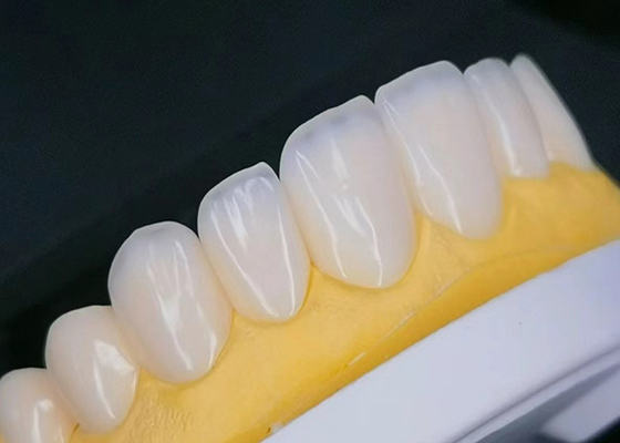satın al Doğal görünümlü Estetik Restorasyonlar için leke dayanıklı EMAX Porselen Fineri online manufacture
