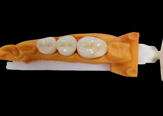 satın al Çin diş laboratuvarından çip ve leke direnci ve doğal estetiği ile giyim dayanıklı zirkonya diş tacı online manufacture