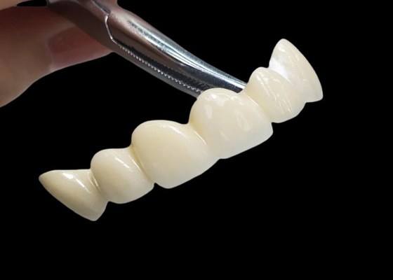 satın al Çin diş laboratuvarından gelen yüksek dayanıklılıklı lekelere dayanıklı özel şeffaf zirkonya diş tacı online manufacture