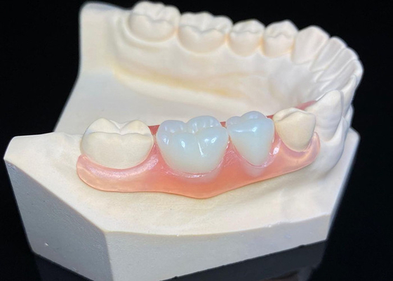 satın al OEM Görünmez çıkarılabilir diş protezleri Özel Akrilik reçine kısmi diş protezi online manufacture