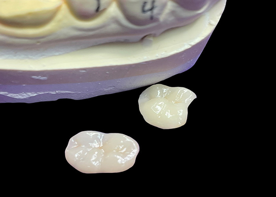 satın al IPS e.max Molar Restorasyonu için Keramik İnlaylar ve Onlaylar Uzun süreli sonuçlar için doğal estetik ve üstün dayanıklılık online manufacture