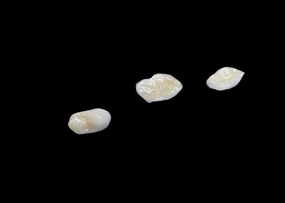 satın al Biyo uyumlu seramik yapıştırmalar ve yapıştırmalar, rahat dayanıklılık ve doğal dişlerle sorunsuz entegrasyon için tasarlanmıştır. online manufacture