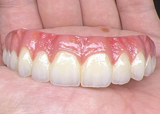 satın al Ağız Sağlığı Diş implantı Desteklenmiş protezler Köprü cilalanmış yüzey Desteklenmiş tam protezler online manufacture