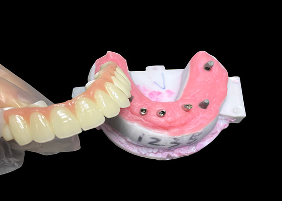 satın al İmplant desteklenmiş Tam kemerli diş protezi Sabit diş implantı Seramik taç köprüsü online manufacture