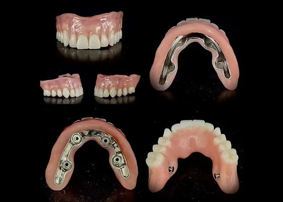 satın al Kesin Çubuk İmplantı Desteklenmiş Hibrit Diş Ekimi Güvenli Uyum Düzenlenebilir Denge online manufacture