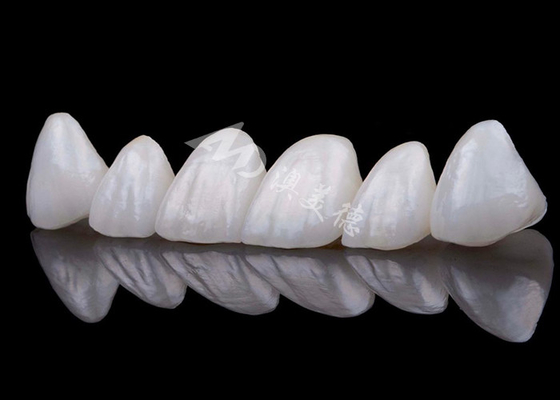 satın al Doğal Görünümlü Zirkonya Diş Tacı leke Direnci Tüm Zirkonya Tacı online manufacture
