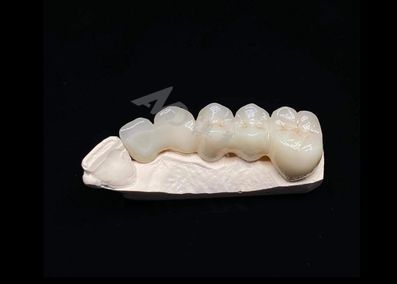 satın al Çaprazlık Doğal Estetik Dişler İçin Katı Zirkonya Tacı Parçalanmaya Karşı Dayanıklı online manufacture