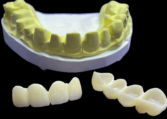 satın al Vita'da lekeye dayanıklı diş porselen taçları ve köprüleri Doğal Estetik için Klasik Tonlar online manufacture