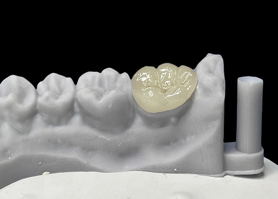 satın al Dental Ceramic Onlays, Porselen Inlays ve Onlays FDA tarafından onaylanmıştır. online manufacture