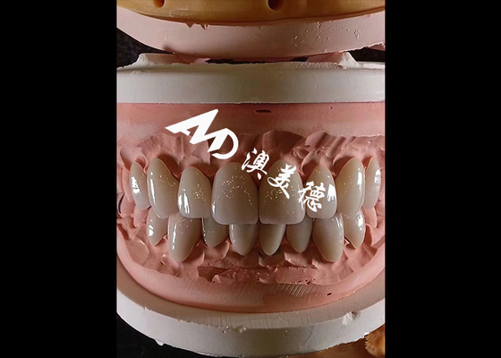 satın al Kozmetik Diş Hekimliği EMAX Estetik Restorasyonlar İçin 0.3-0.5 mm Kalınlığında Diş Finerleri online manufacture