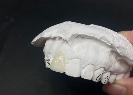 İyi bir fiyat. Şeffaf Özel Diş Finerleri Uzun Süren Gülümsemenin Hızlı ve Etkili Çözümleri çevrimiçi