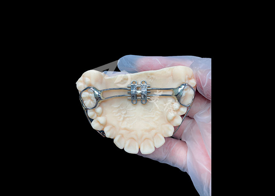 satın al MSE palatal expander Etkili Diş Hizalama için Yenilikçi Ortodontik Aletler online manufacture