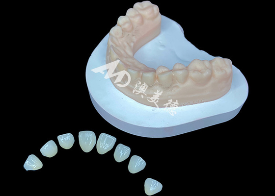 satın al IPS e.max Veneer, çarpıcı gülümseme dönüşümleri için Premium Estetik Çözüm online manufacture