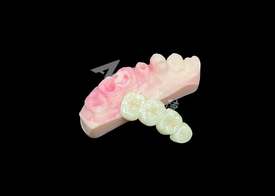 satın al Doğal Görünümlü Diş Estetiği için Üstün Katı Zirkonya Taç Köprüsü online manufacture