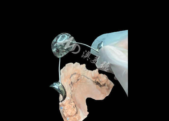 İyi bir fiyat. Ortodontik Nance Aygıtı Optimal Çene Istikrarı ve Uzay Koruma Çözümü çevrimiçi