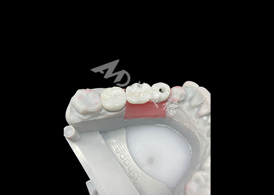 satın al Daha rahat ve estetik için titanyum abutmentli zirkonya diş implant taçları online manufacture