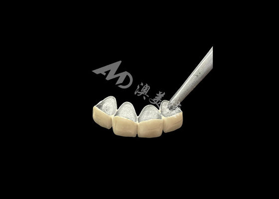satın al Daha iyi korozyon direnciyle metal tacı ile erimiş porselen online manufacture