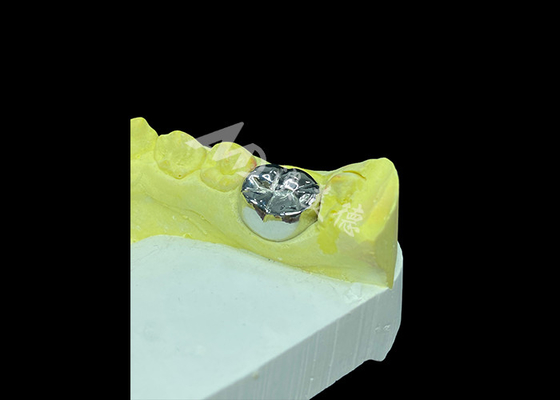 satın al Uzun süreli fonksiyon dayanıklı tam metal dökme taç üstün diş restorasyonu için online manufacture