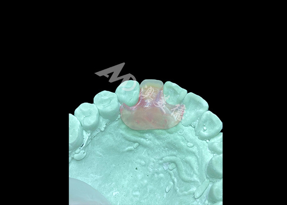 satın al Hafif ve Konforlu Nesbit Fleksibel Diş Dentüsü Tek Dişle Dönüştürülür online manufacture