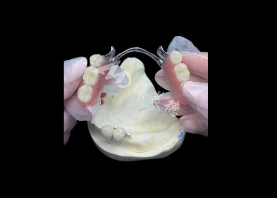 satın al Dayanıklı Porselen Metal Dental Taç PFM Taç Restorasyon için online manufacture