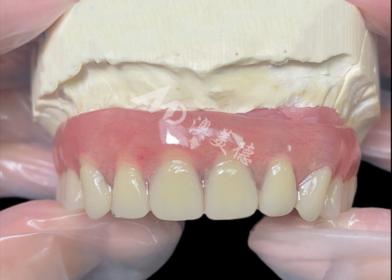 satın al Titanyum implant desteklenen Bar Bağlantı Çin diş laboratuvarından diş protezleri online manufacture