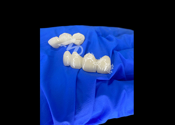 satın al Wieland Zenostar Keramik Taç Köprüsü Uzun ömürlü ve doğal görünümlü restorasyonlar için yüksek hassasiyet online manufacture