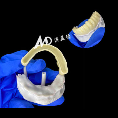 satın al PMMA, istikrar ve doğal iyileşme için içi boş olan geçici implant köprüsü, Yüksek hassasiyetli CAD/CAM imalatı, Biyolojik uyumlu PMMA malzemesi online manufacture