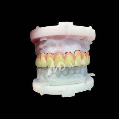 satın al Temiz Titanyum Keramik Taç ve Köprü Dayanıklı Hafif Estetik Restorasyonlar online manufacture