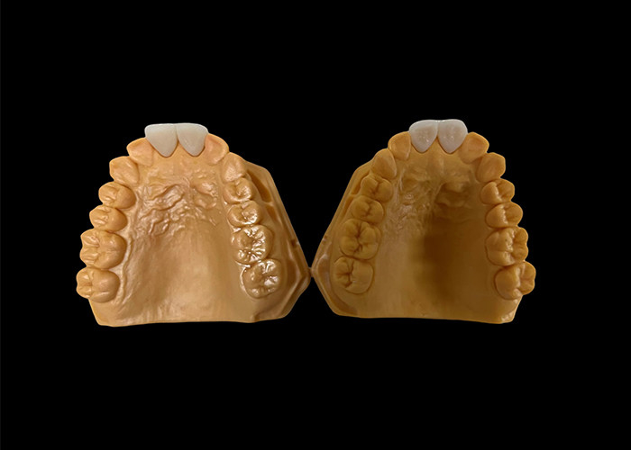 Özel Aesthetic Zirconia Diş Tacı Ön ve Arka Dişler için Mükemmel