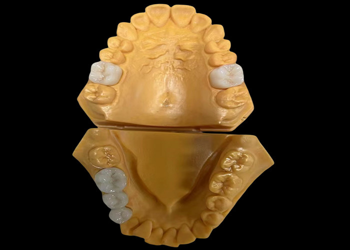 Özel Aesthetic Zirconia Diş Tacı Ön ve Arka Dişler için Mükemmel