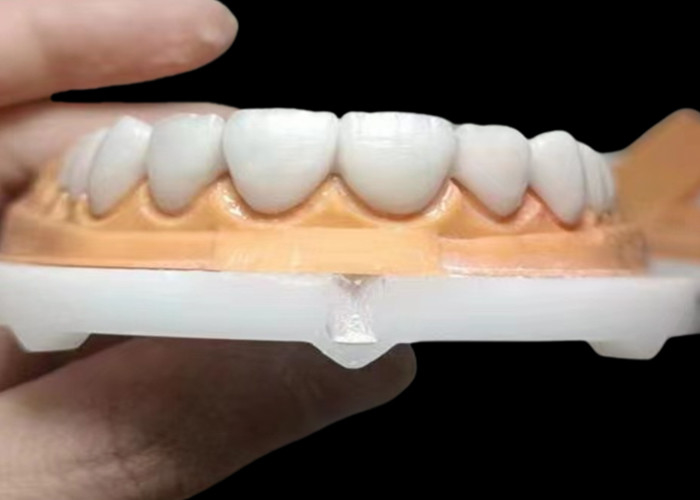 Çin diş laboratuvarından gelen yüksek dayanıklılıklı lekelere dayanıklı özel şeffaf zirkonya diş tacı