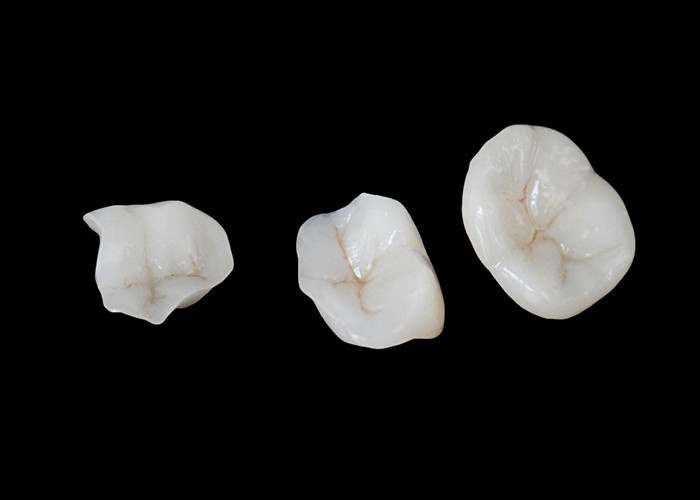 Biyo uyumlu seramik yapıştırmalar ve yapıştırmalar, rahat dayanıklılık ve doğal dişlerle sorunsuz entegrasyon için tasarlanmıştır.