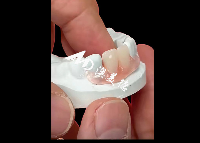 Nesbite esnek protezleri rahat ve doğal görünümlü bir gülümseme için kusursuz bir çözüm sunar