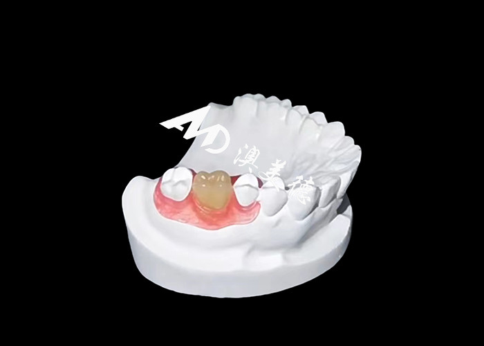Nesbite esnek protezleri rahat ve doğal görünümlü bir gülümseme için kusursuz bir çözüm sunar