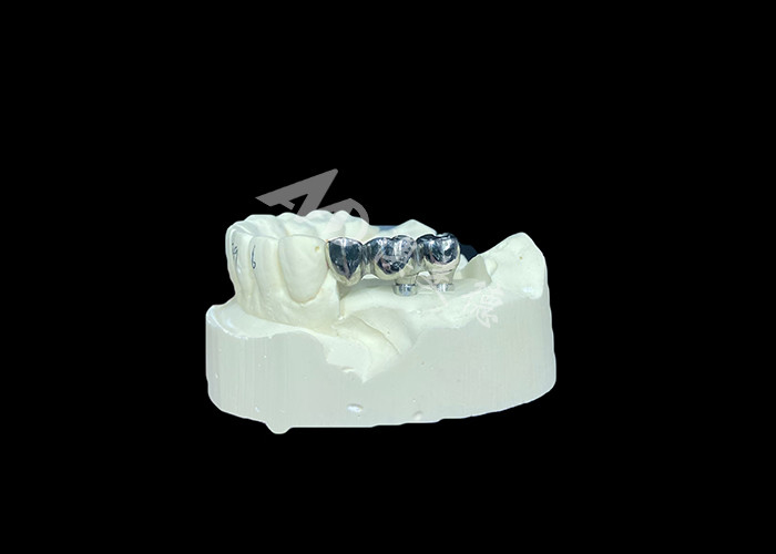 Uzun süreli tam kalıcı Titanyum Taç Diş İmplantı Eksik Dişler için Molar