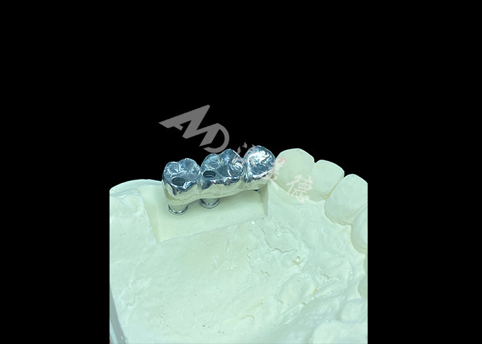 Uzun süreli tam kalıcı Titanyum Taç Diş İmplantı Eksik Dişler için Molar