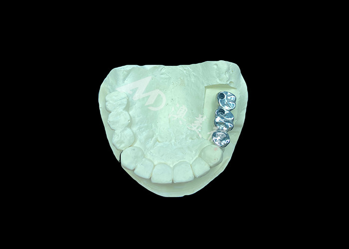 Uzun süreli tam kalıcı Titanyum Taç Diş İmplantı Eksik Dişler için Molar