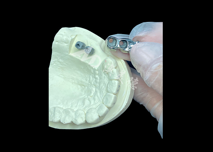 Uzun süreli tam kalıcı Titanyum Taç Diş İmplantı Eksik Dişler için Molar