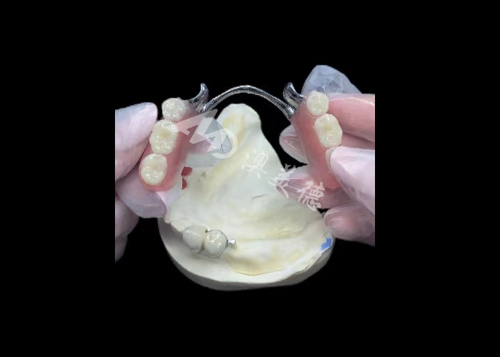 Dayanıklı Porselen Metal Dental Taç PFM Taç Restorasyon için