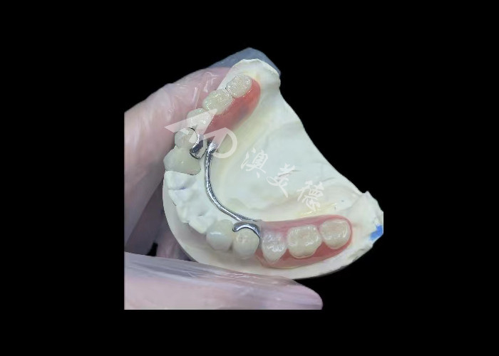 Dayanıklı Porselen Metal Dental Taç PFM Taç Restorasyon için