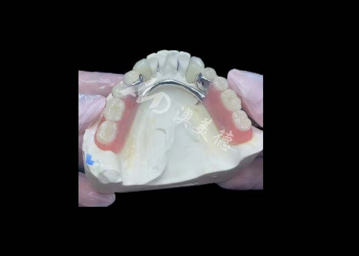 Dayanıklı Porselen Metal Dental Taç PFM Taç Restorasyon için