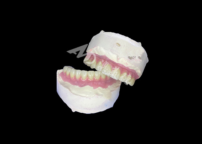 Dental All-on-6 Dental Implant Desteklenmiş Diş Dişleri Dayanıklı ve Rahat