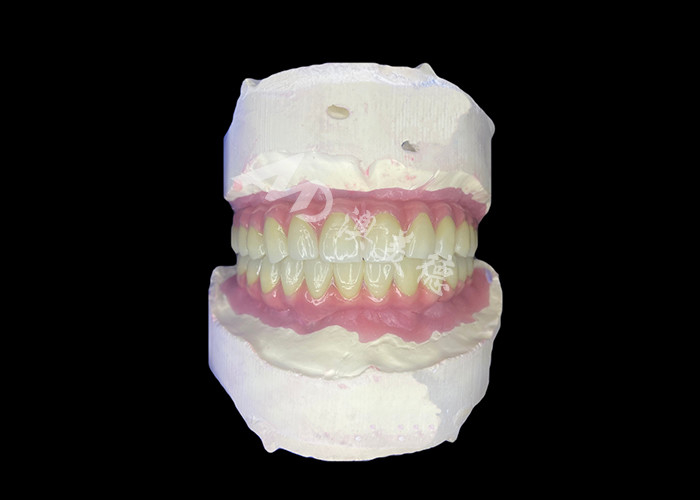 Dental All-on-6 Dental Implant Desteklenmiş Diş Dişleri Dayanıklı ve Rahat