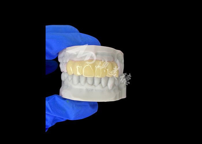 Yumuşak Bio uyumlu 3D basılı Çürük Geçici Köprüsü İmplant öncesi Restorasyonlar için