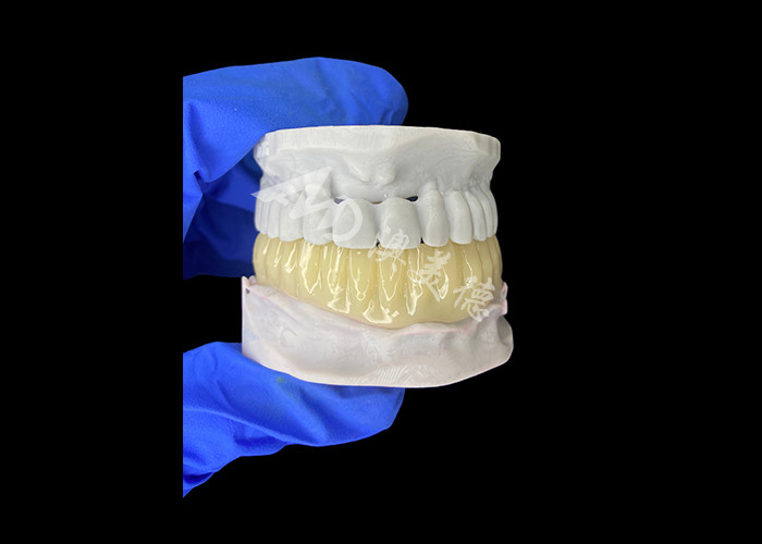 Yumuşak Bio uyumlu 3D basılı Çürük Geçici Köprüsü İmplant öncesi Restorasyonlar için