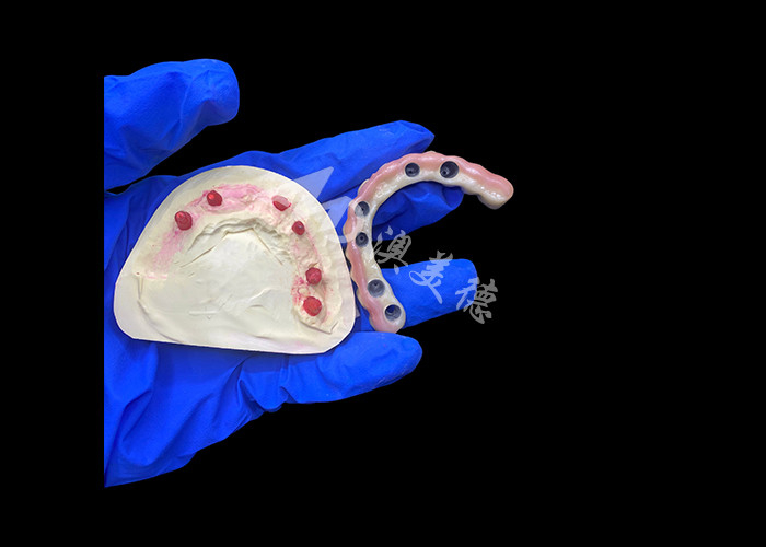 Titanyum Abutment ve Zirconia Taç İmplantı Desteklenen Diş Dişleri Rahat giyim için uygun hassaslık